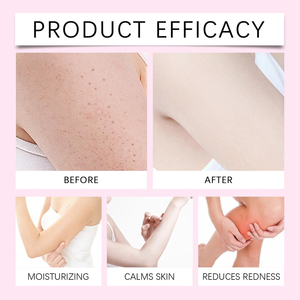 Cyperus Rotundus Oil for Hair Removal Smoothing Soothing Skin Care Moisturizes Armpit Leg Arm Hair Inhibitor Depilatory Oil